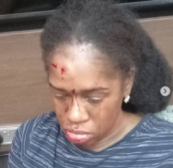 Uber driver allegedly assaulted a lady after an argument over the price stipulated on the app. OAP Calls for justice