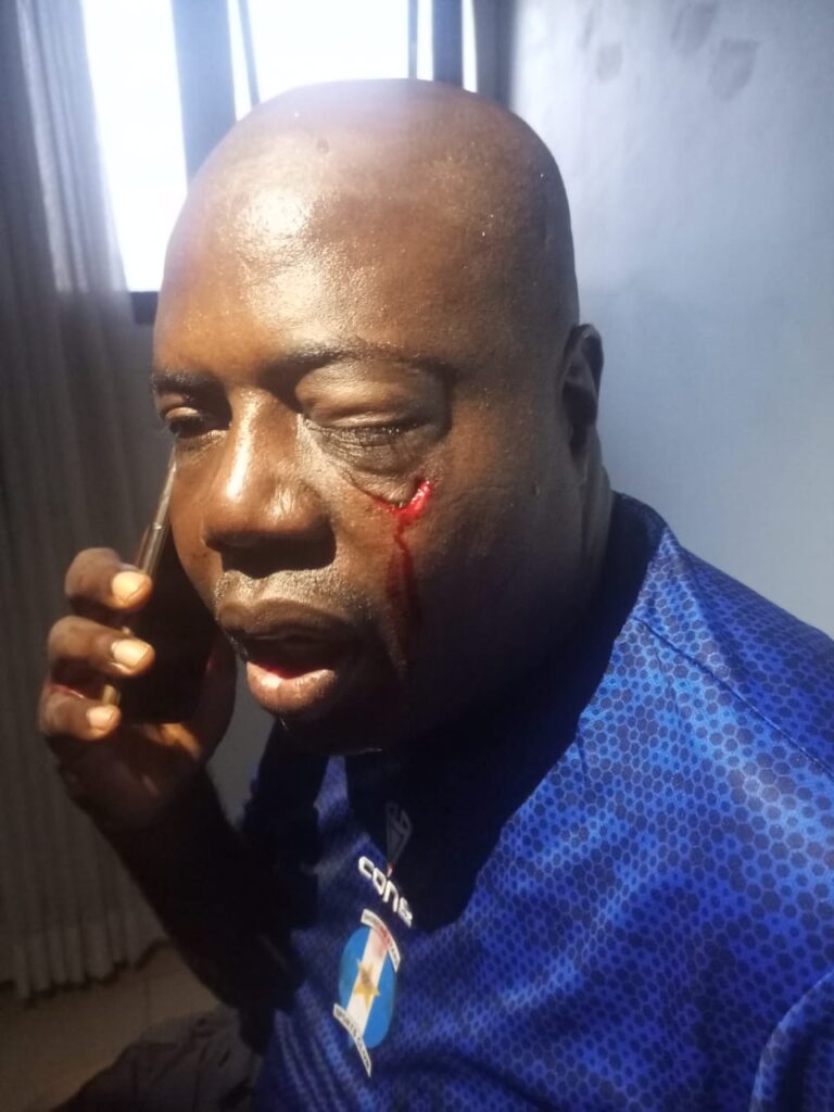 Hoodlums attack Oyo State Sports Council Chairman