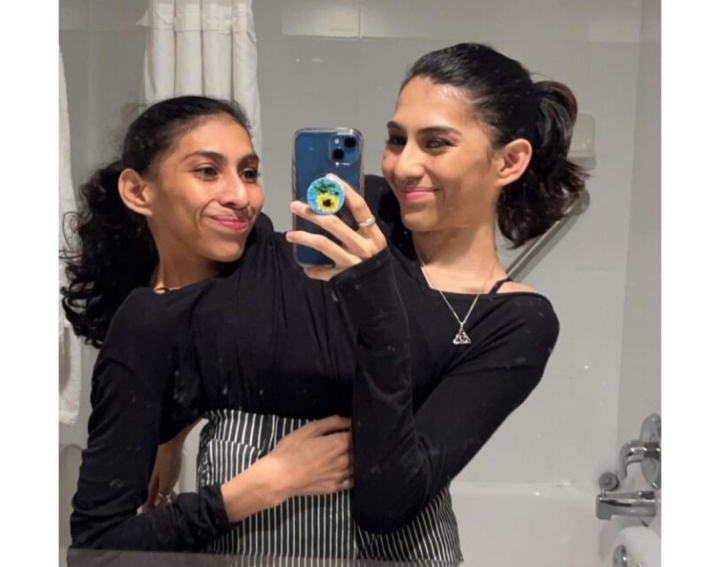 We share the same genitals, but only one of us has a boyfriend” – Conjoined twins open up about their dating lives