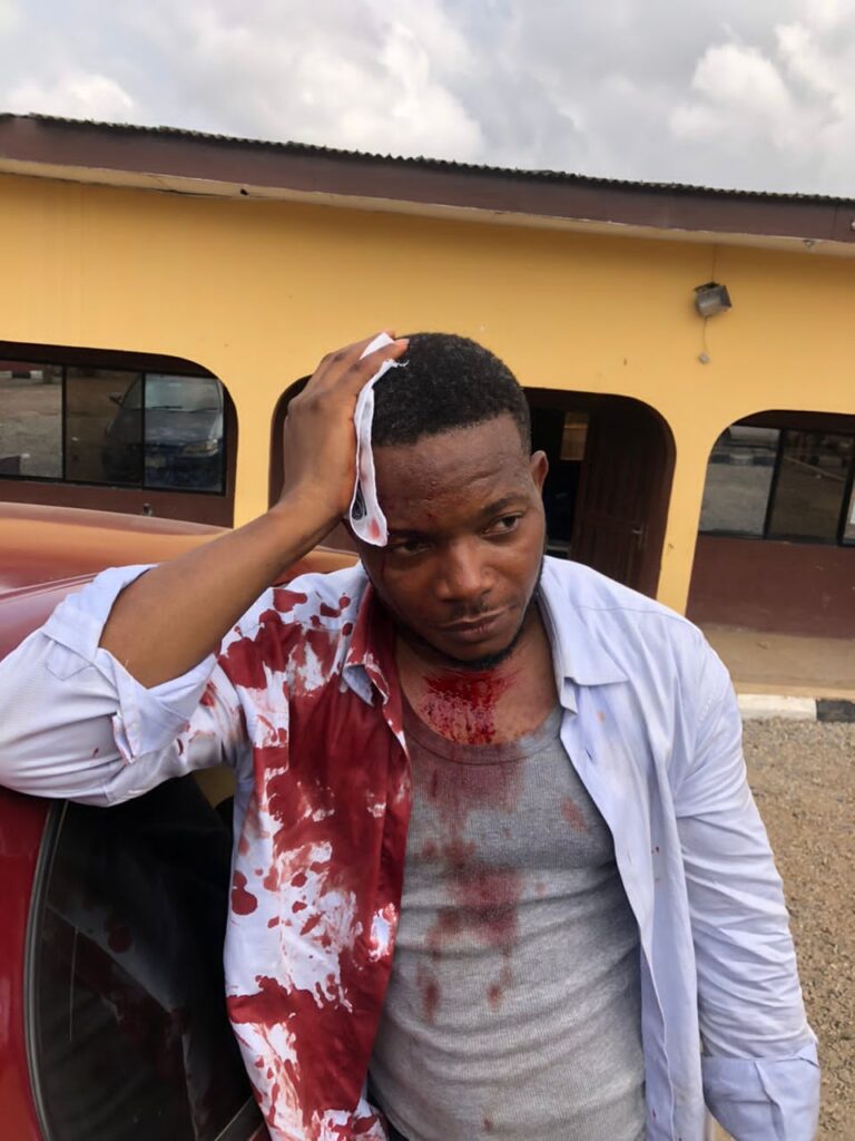 Journalists demand justice for brutalised colleague by DSS officers in Oyo