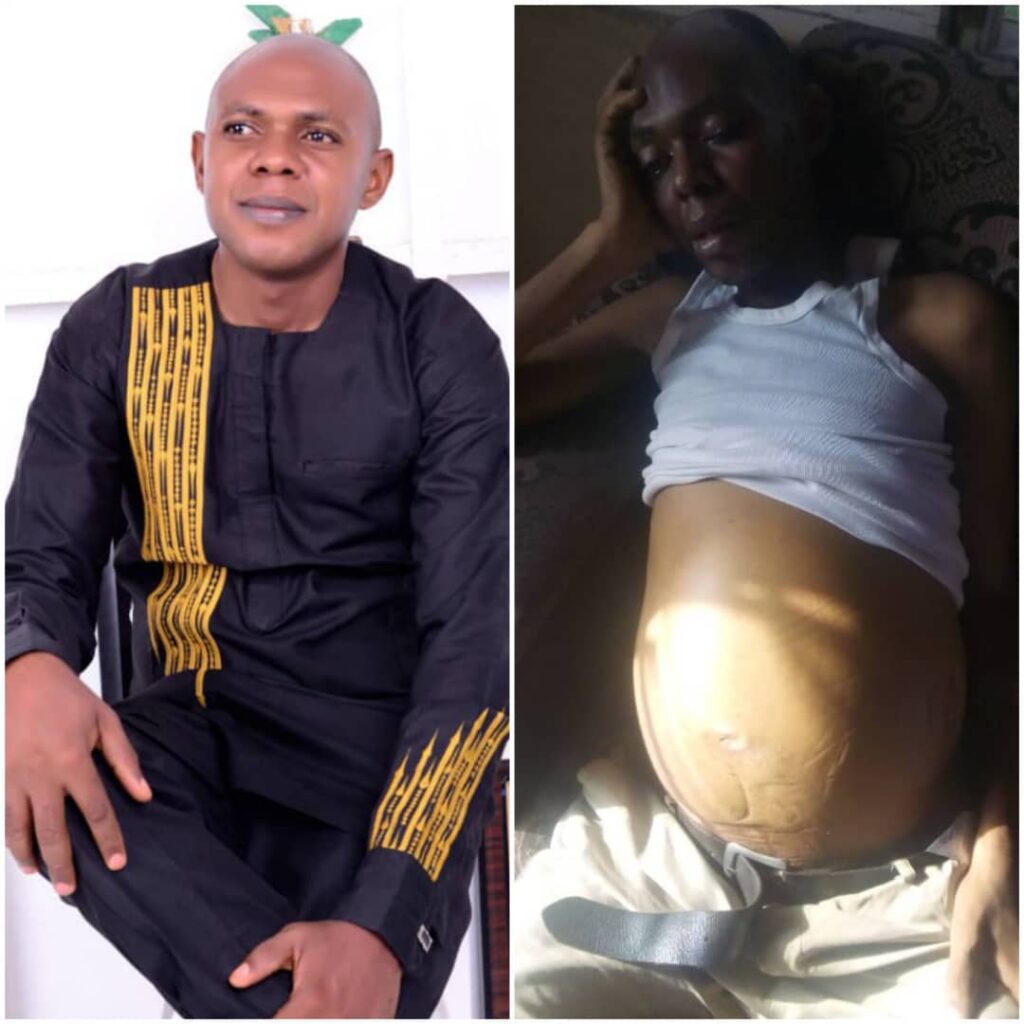 42-yr-old man seeks financial assistance for Liver, Kidney failure treatment