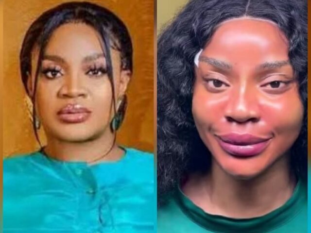Love Yourself, But Enhance If You Want”: Uche Ogbodo Flaunts New Face, Advocates Safe Aesthetics.